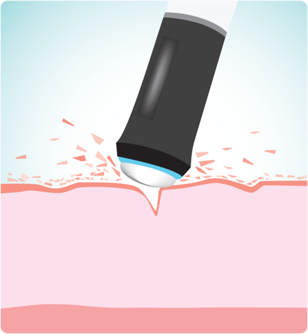 Oxygeneo-how-it-works